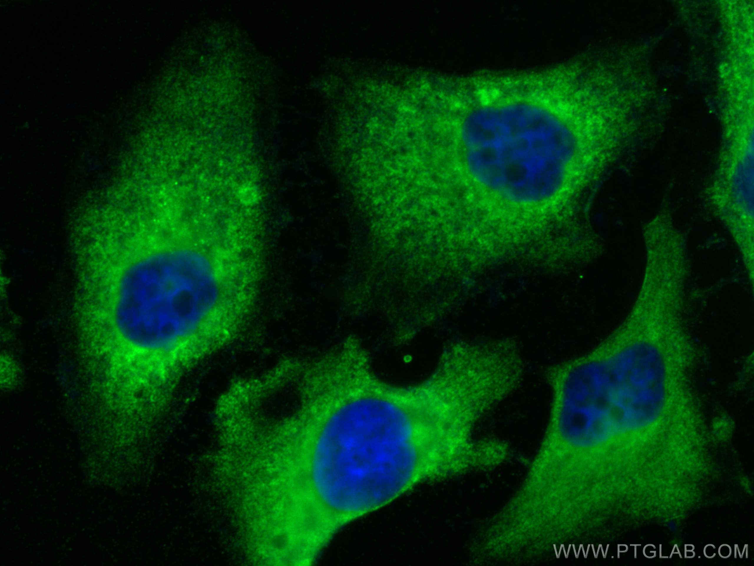 IF Staining of HeLa using 18987-1-AP