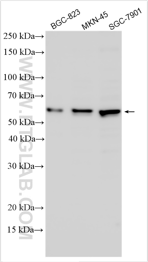 WB analysis using 31420-1-AP