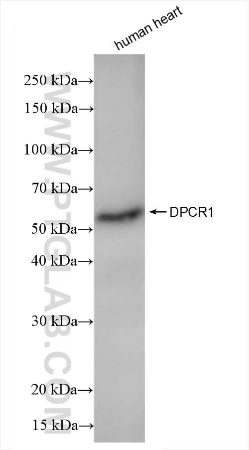 DPCR1