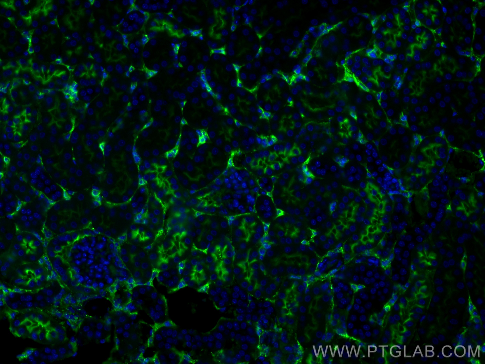 IF Staining of mouse kidney using 68081-1-Ig (same clone as 68081-1-PBS)