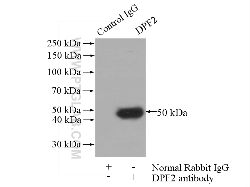 IP experiment of Jurkat using 12111-1-AP