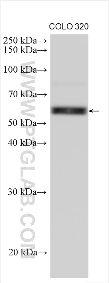 WB analysis using 12367-1-AP