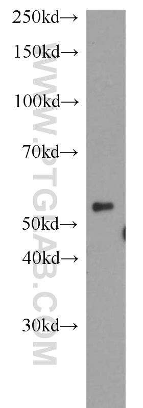 WB analysis of HeLa using 14866-1-AP