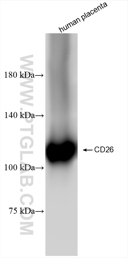 DPP4/CD26