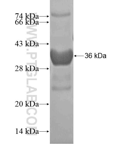 DPPA5 fusion protein Ag20450 SDS-PAGE