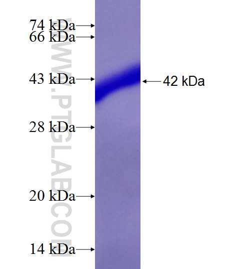 DPY30 fusion protein Ag9370 SDS-PAGE