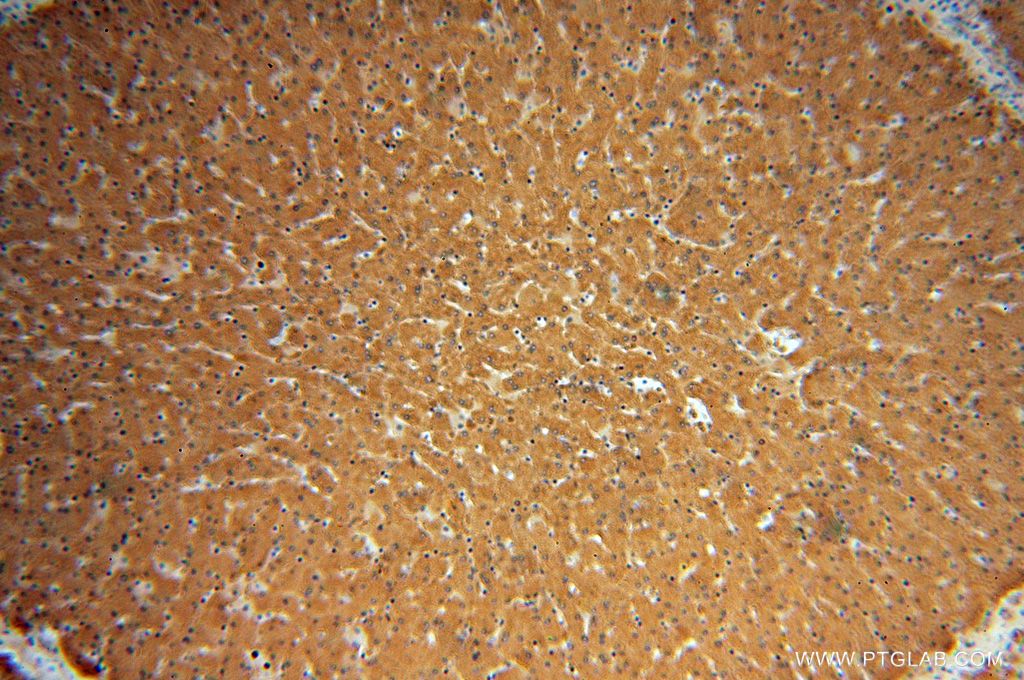 IHC staining of human liver using 13237-1-AP