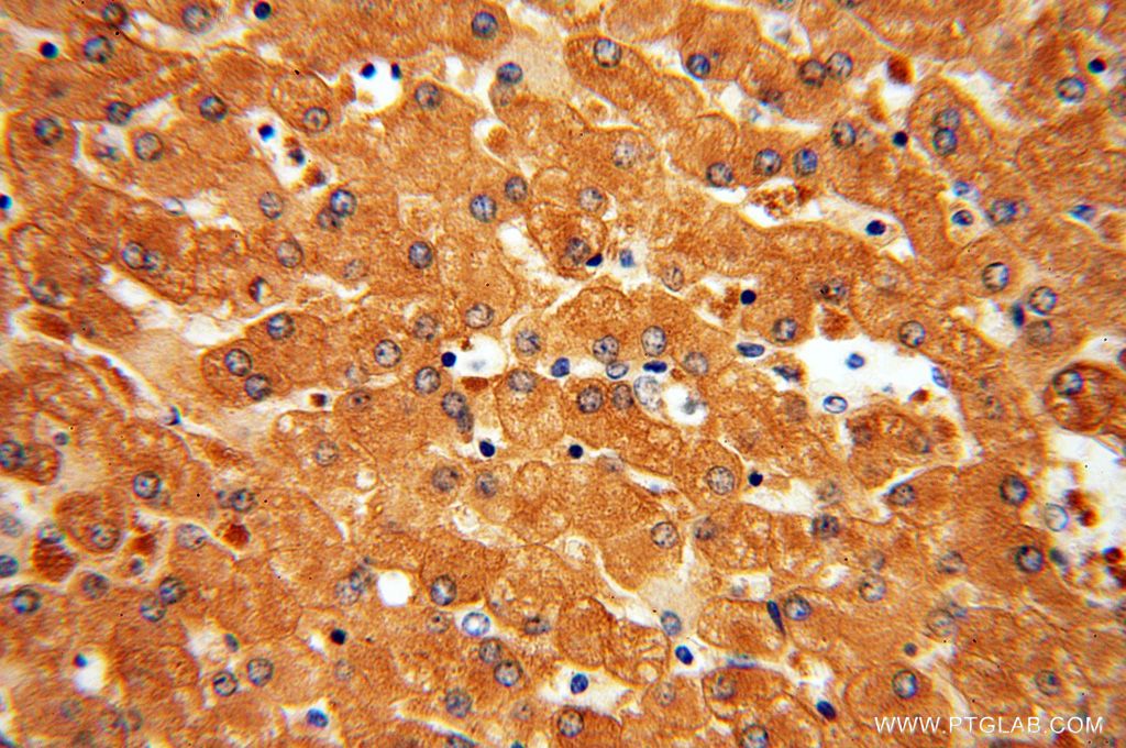 IHC staining of human liver using 13237-1-AP