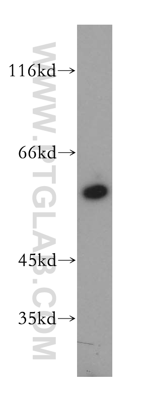 WB analysis of HEK-293 using 13237-1-AP