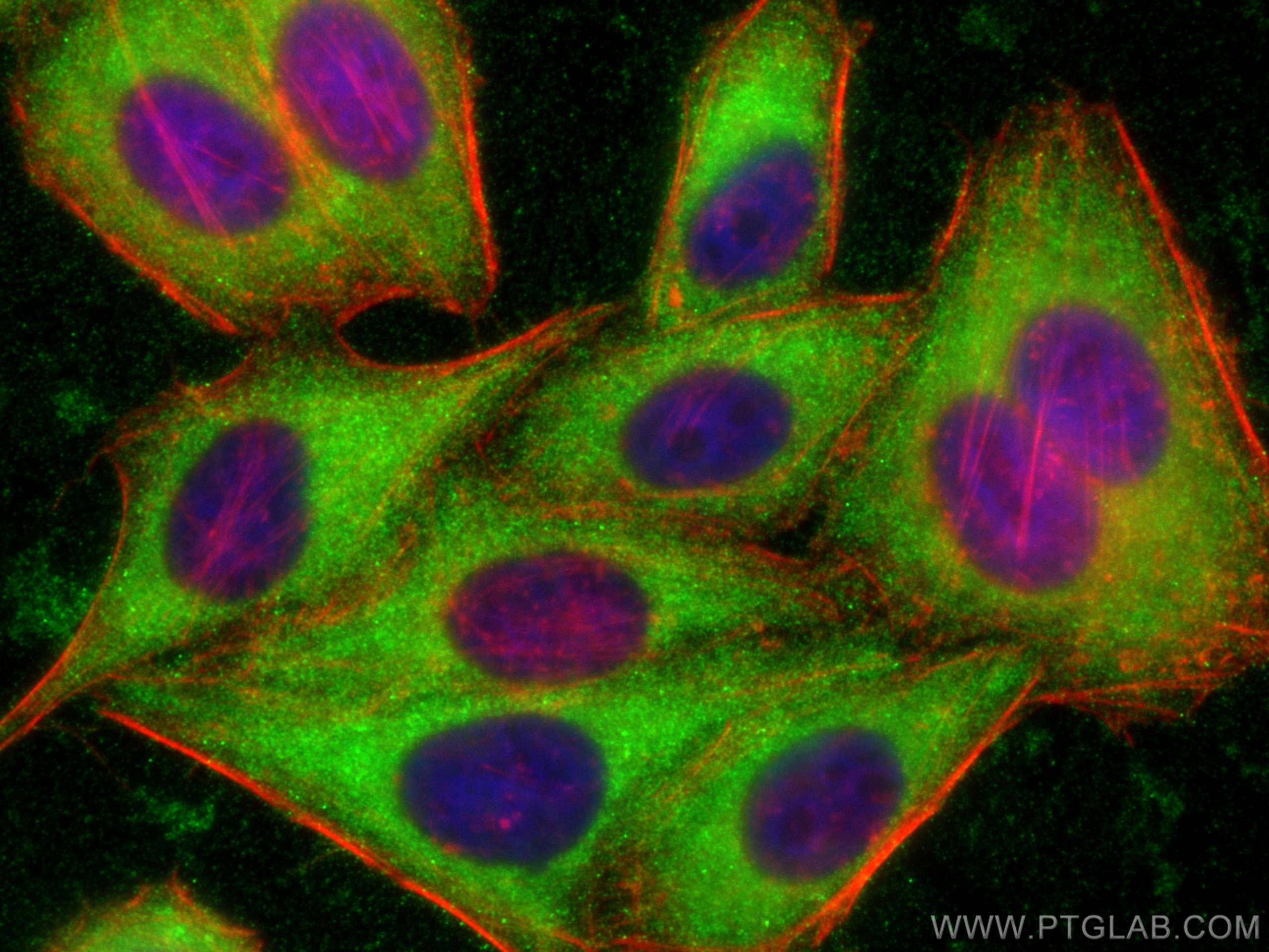 IF Staining of HepG2 using 14686-1-AP