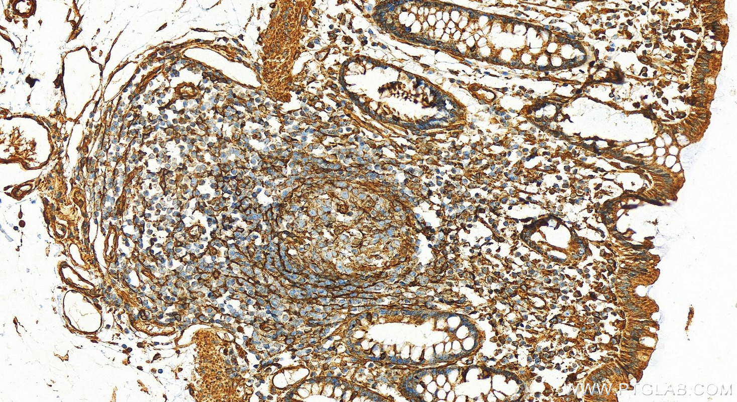 IHC staining of human colon using 13661-1-AP