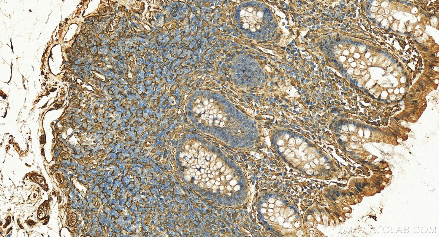 IHC staining of human colon using 18969-1-AP