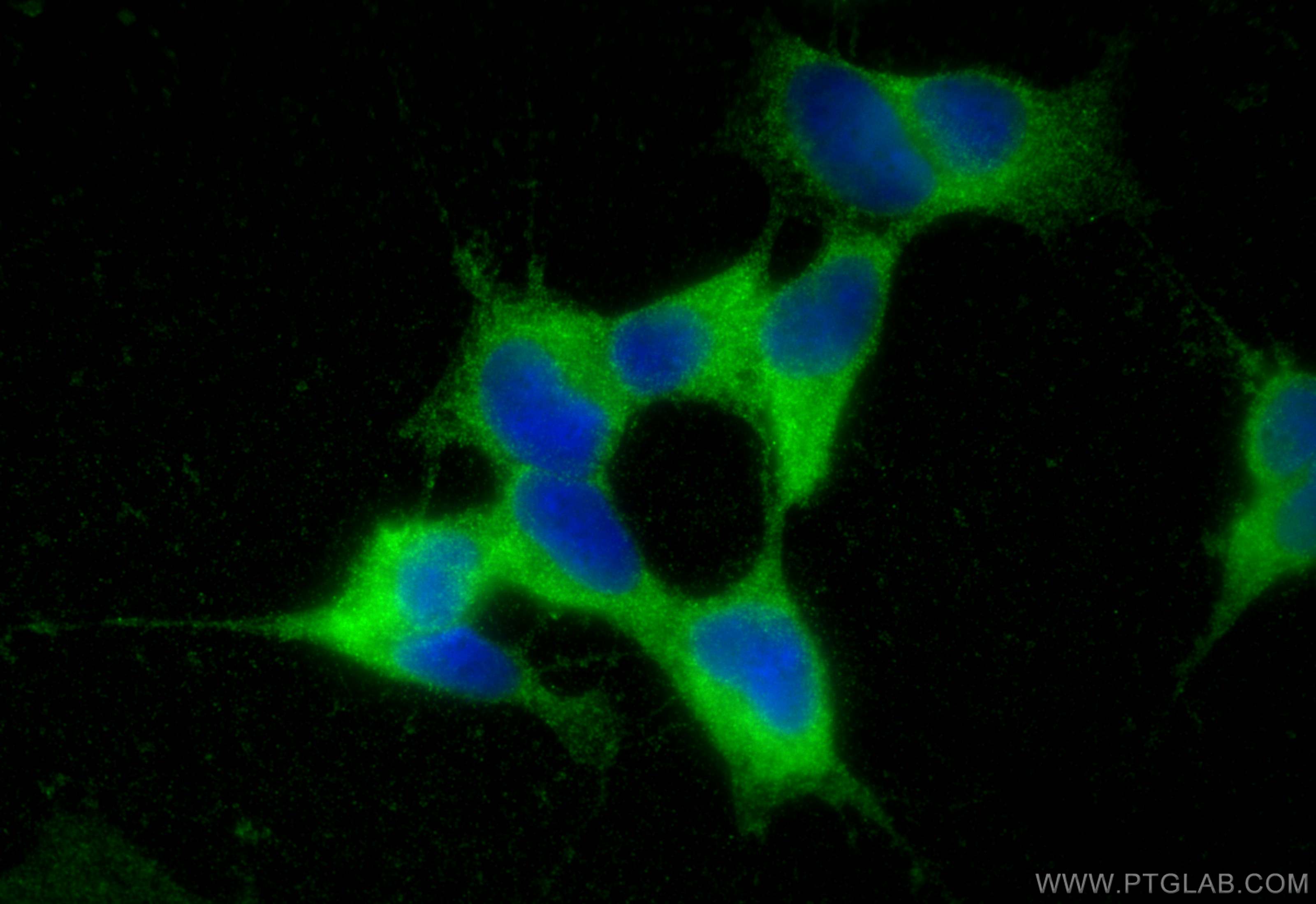 IF Staining of SH-SY5Y using 10525-1-AP