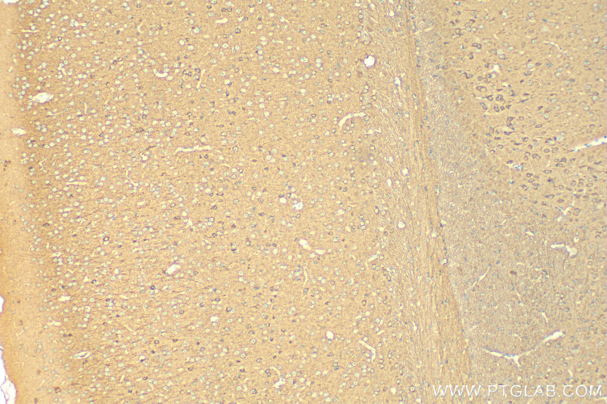 IHC staining of mouse brain using 10525-1-AP