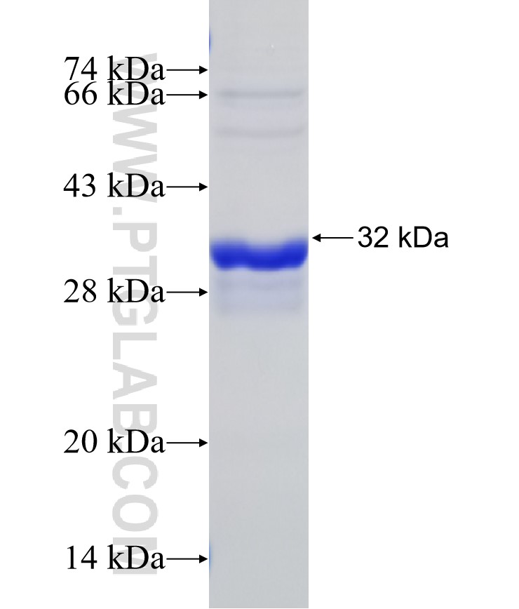 DRD1 fusion protein Ag29521 SDS-PAGE