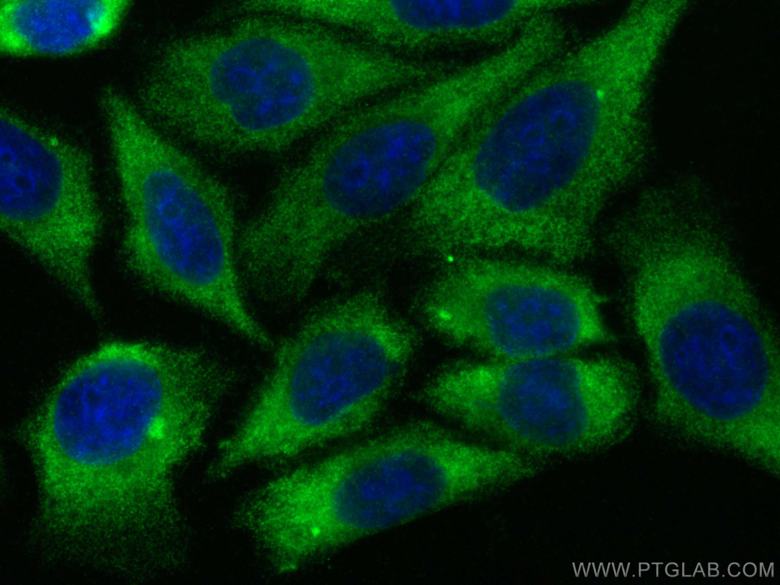 IF Staining of HepG2 using 14743-1-AP