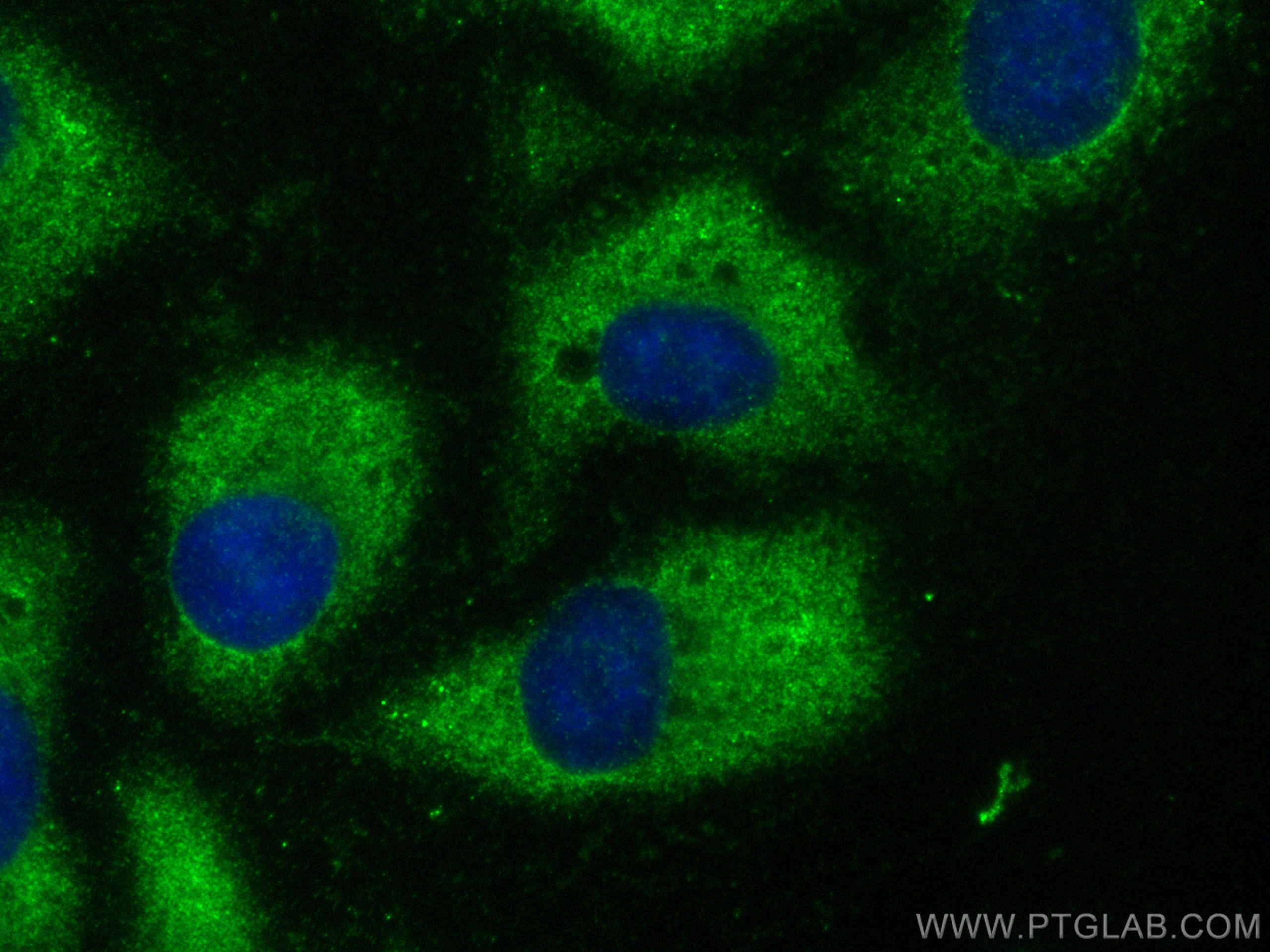 IF Staining of U2OS using 67164-1-Ig (same clone as 67164-1-PBS)