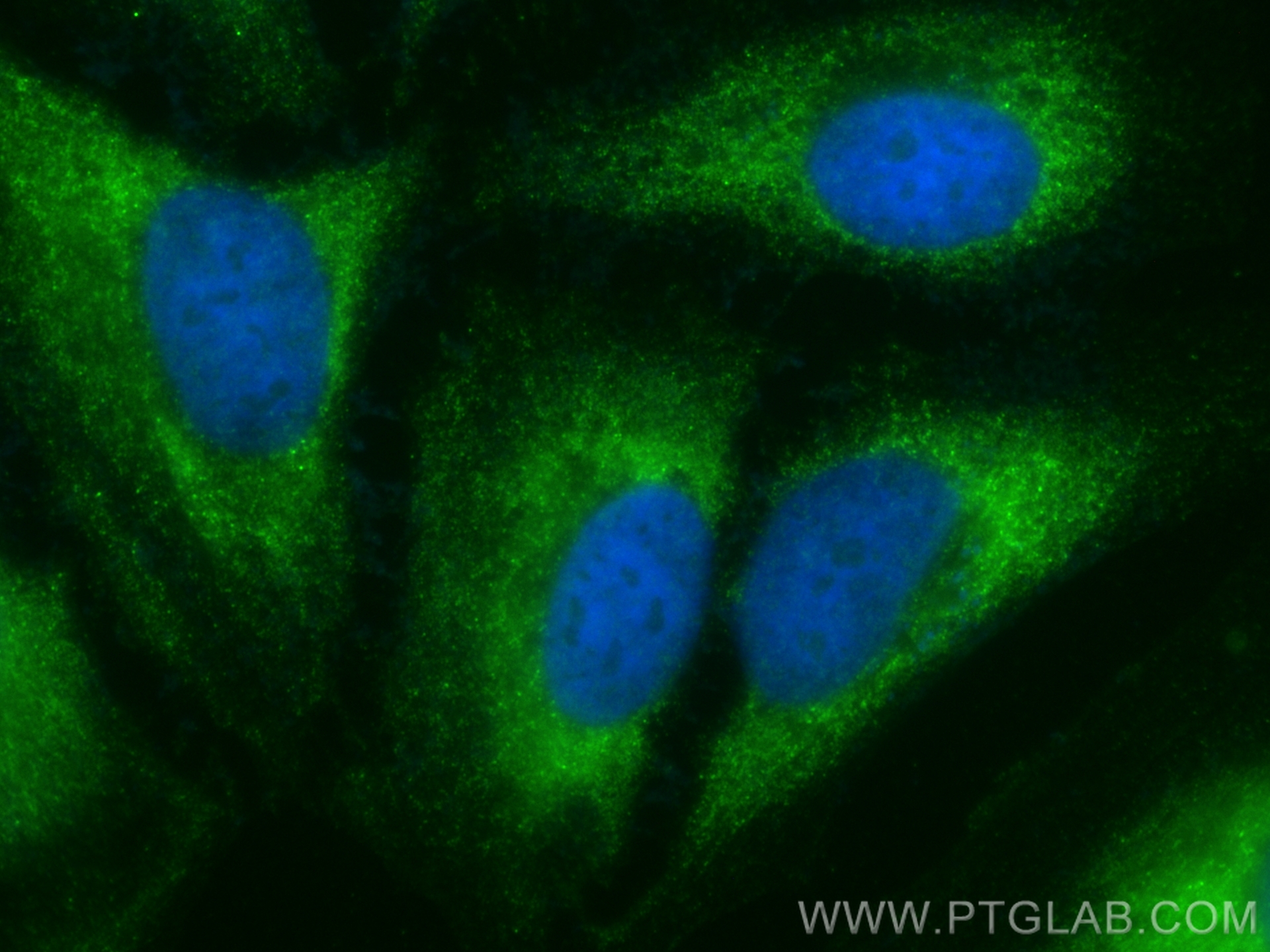 IF Staining of HeLa using CL488-26187