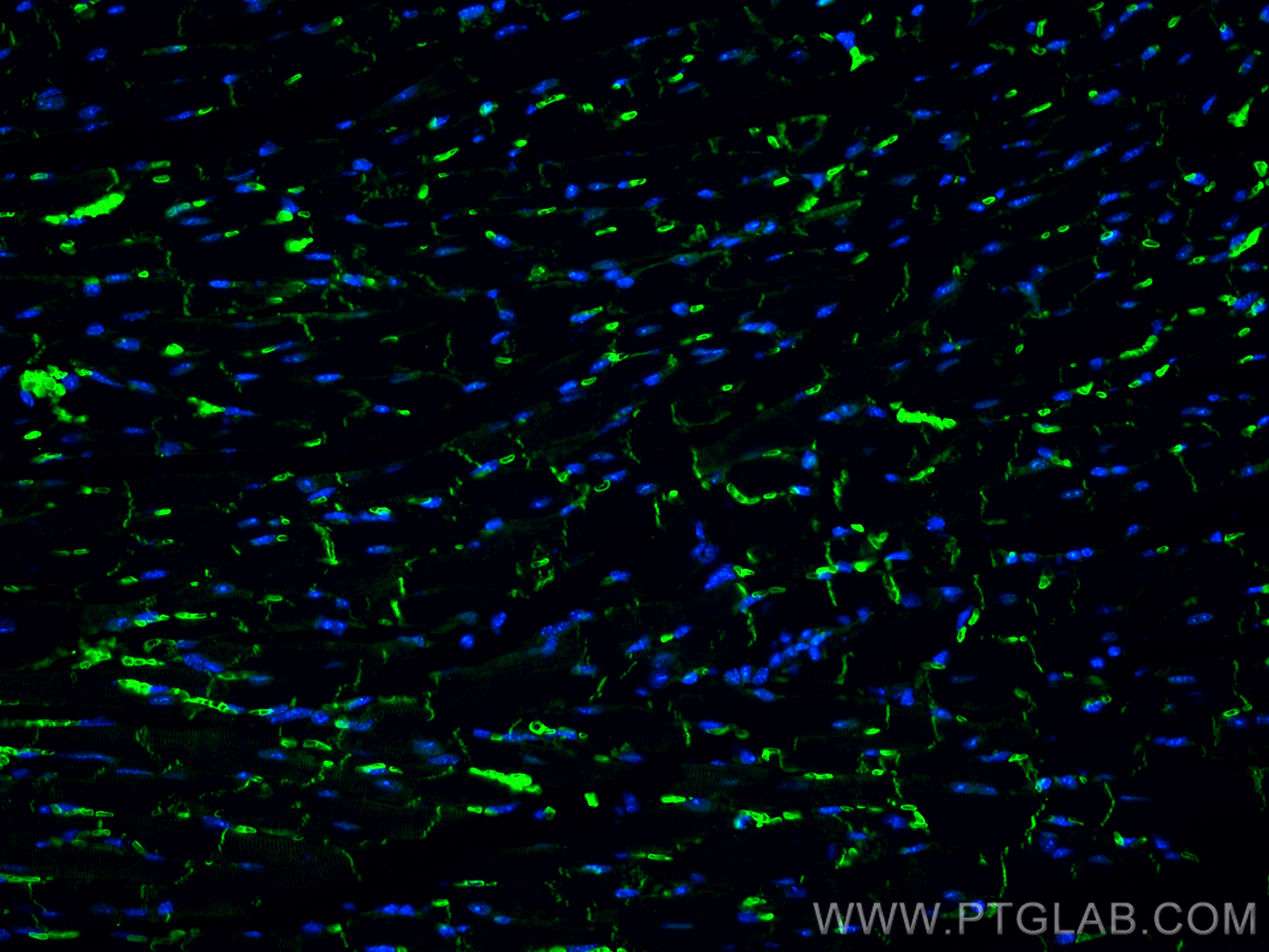 IF Staining of mouse heart using 13876-1-AP