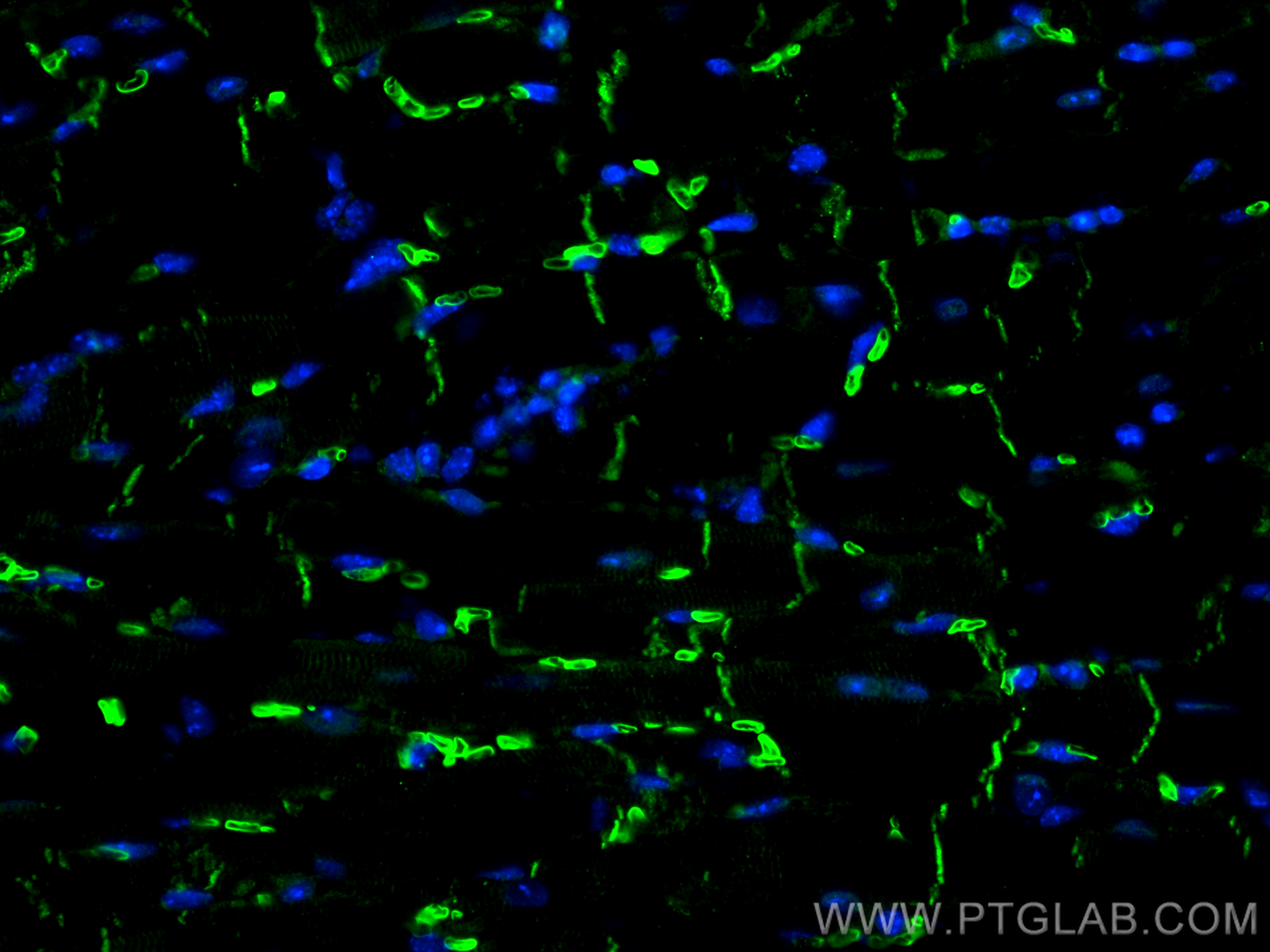 IF Staining of mouse heart using 13876-1-AP