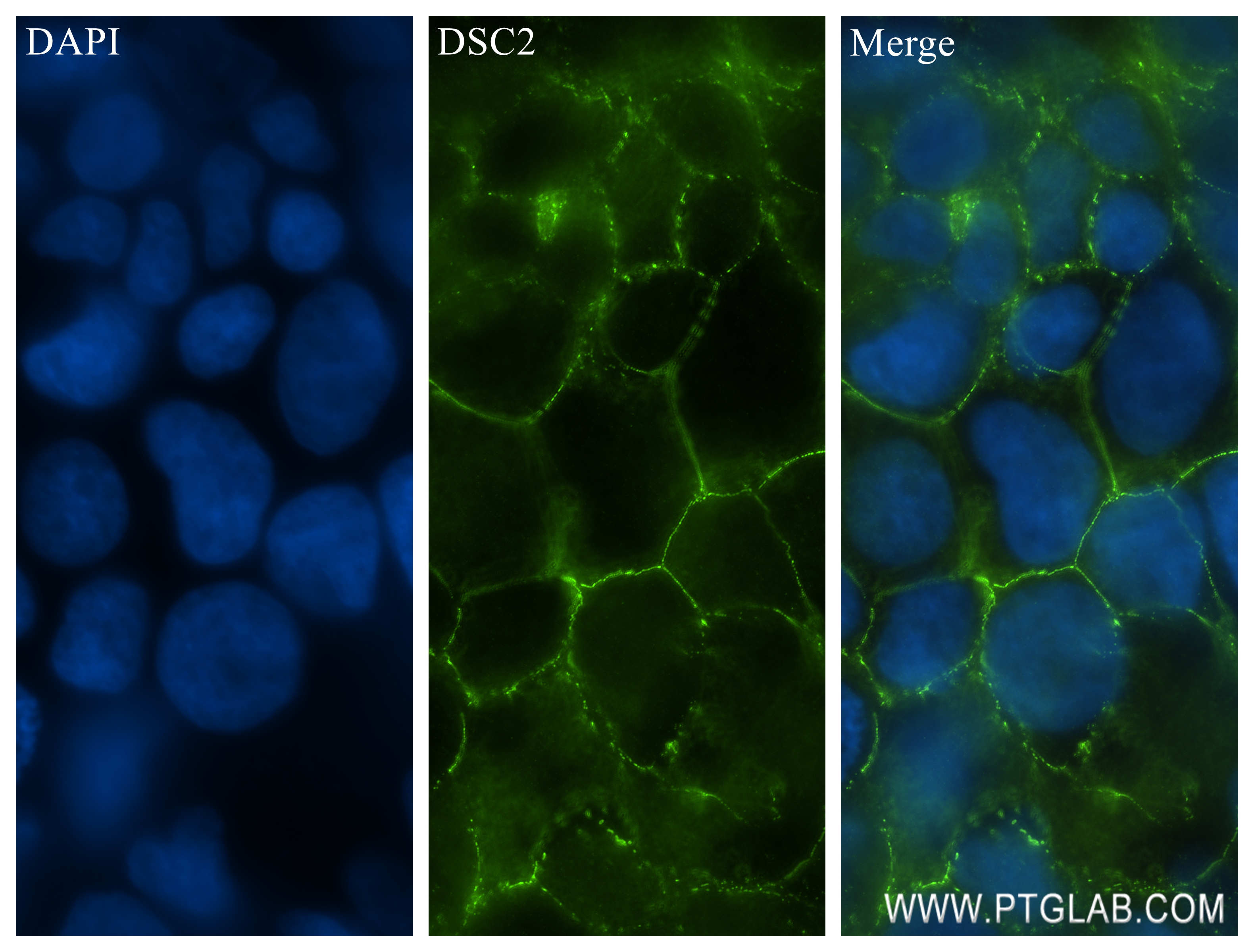 IF Staining of Caco-2 using 84985-1-RR