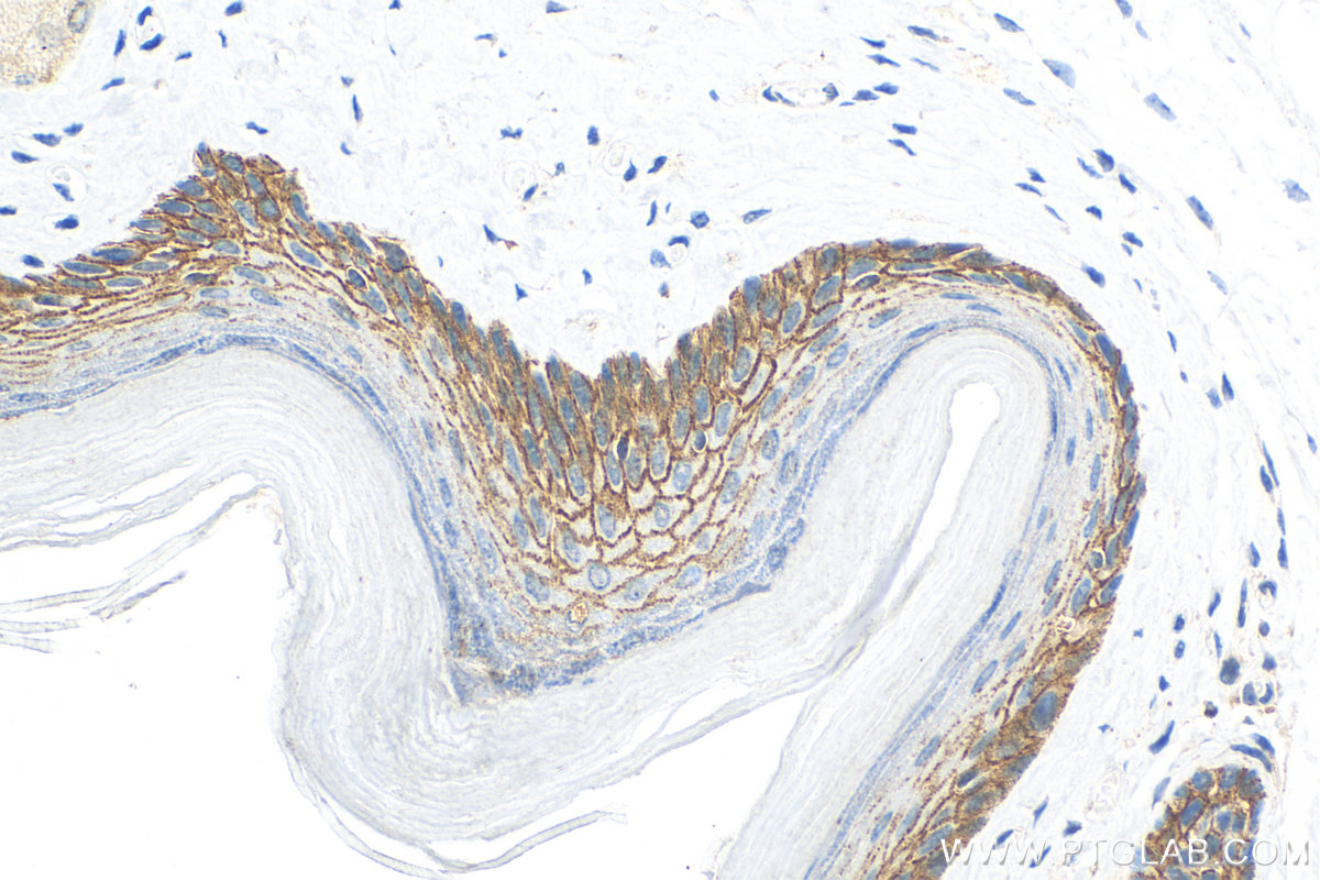 IHC staining of mouse skin using 83386-5-RR