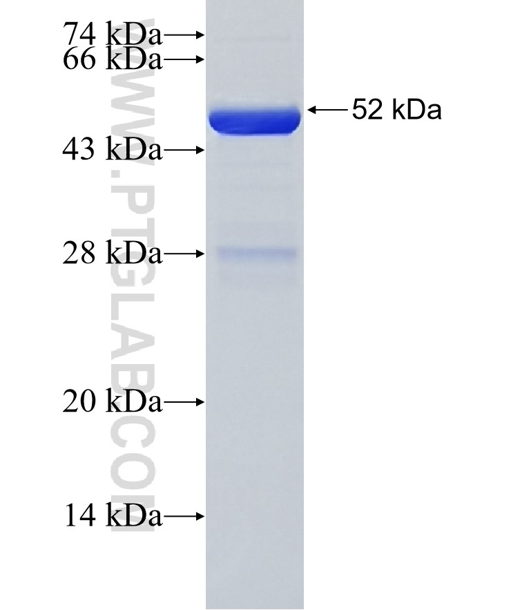DSC3 fusion protein Ag34648 SDS-PAGE