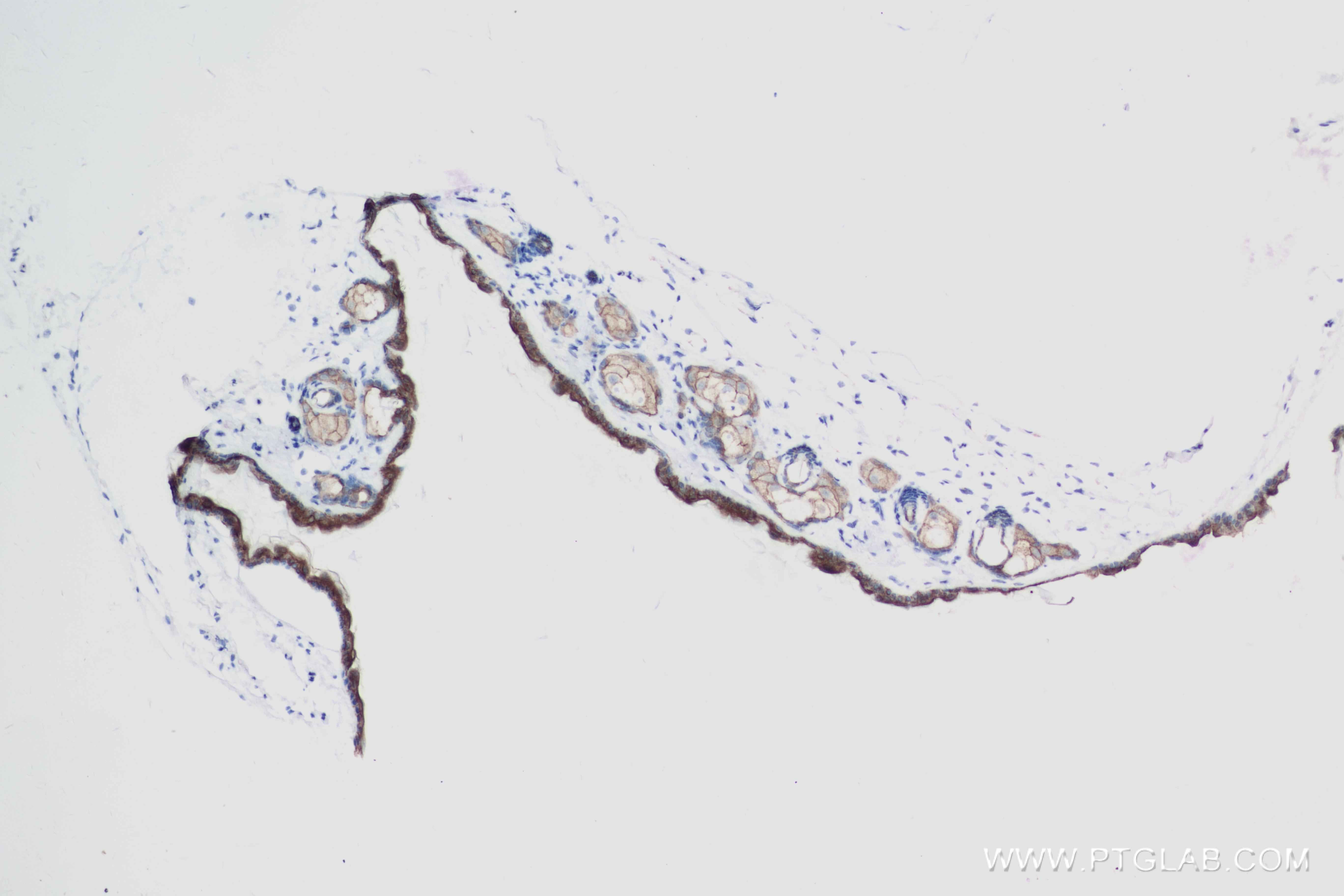 IHC staining of mouse skin using 84053-6-RR