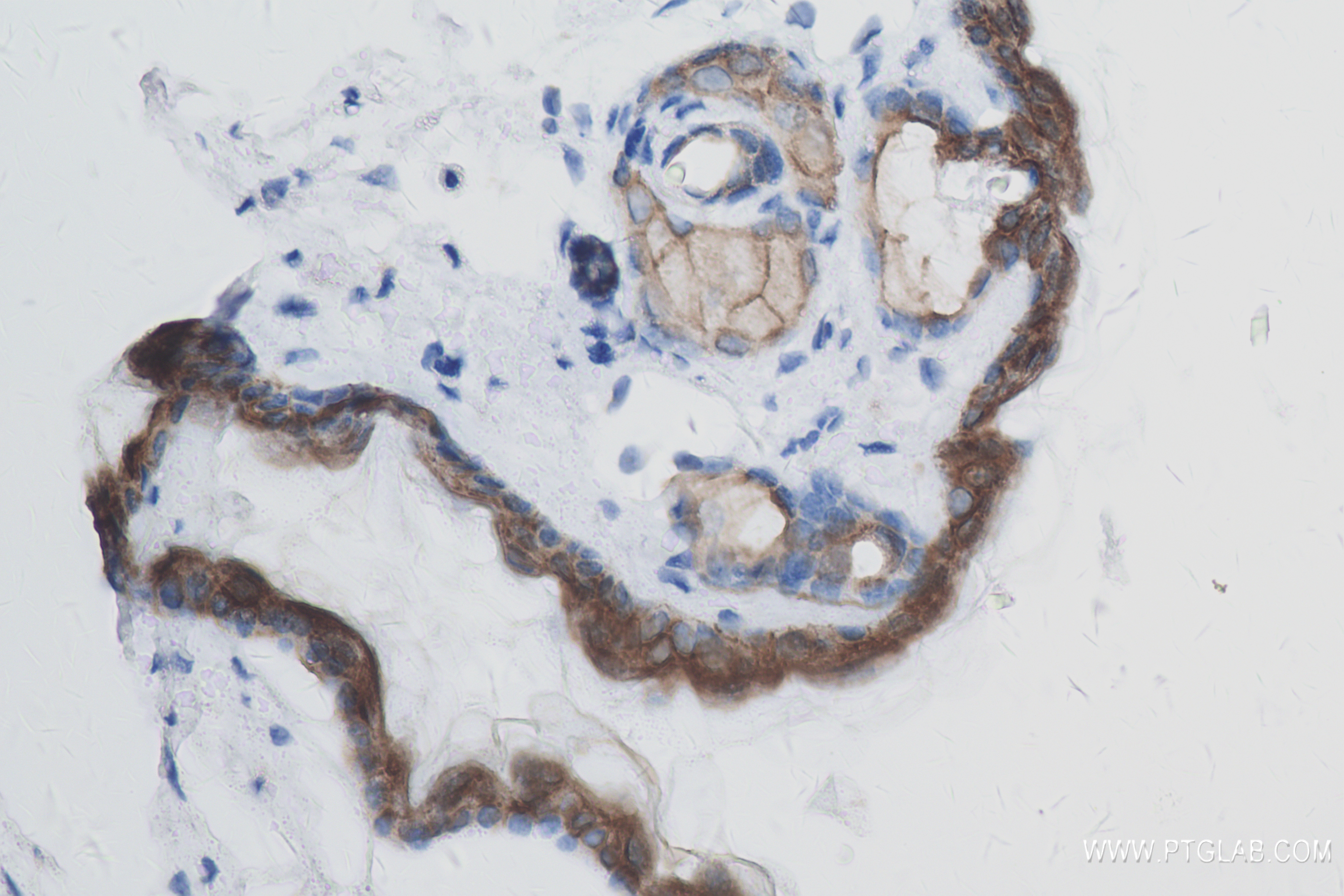 IHC staining of mouse skin using 84053-6-RR (same clone as 84053-6-PBS)