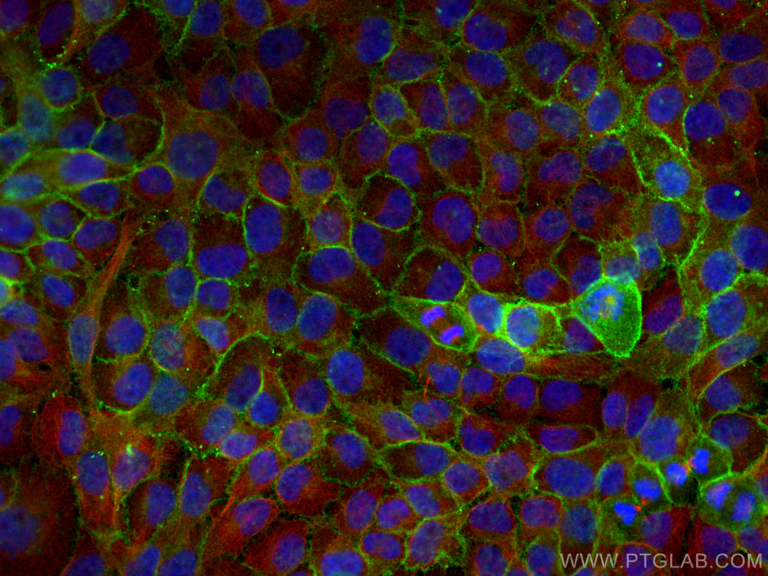 IF Staining of HaCaT using 29942-1-AP