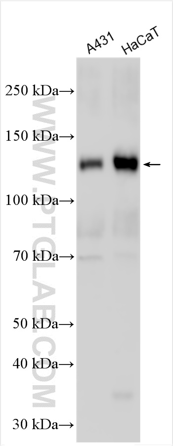 WB analysis using 29942-1-AP