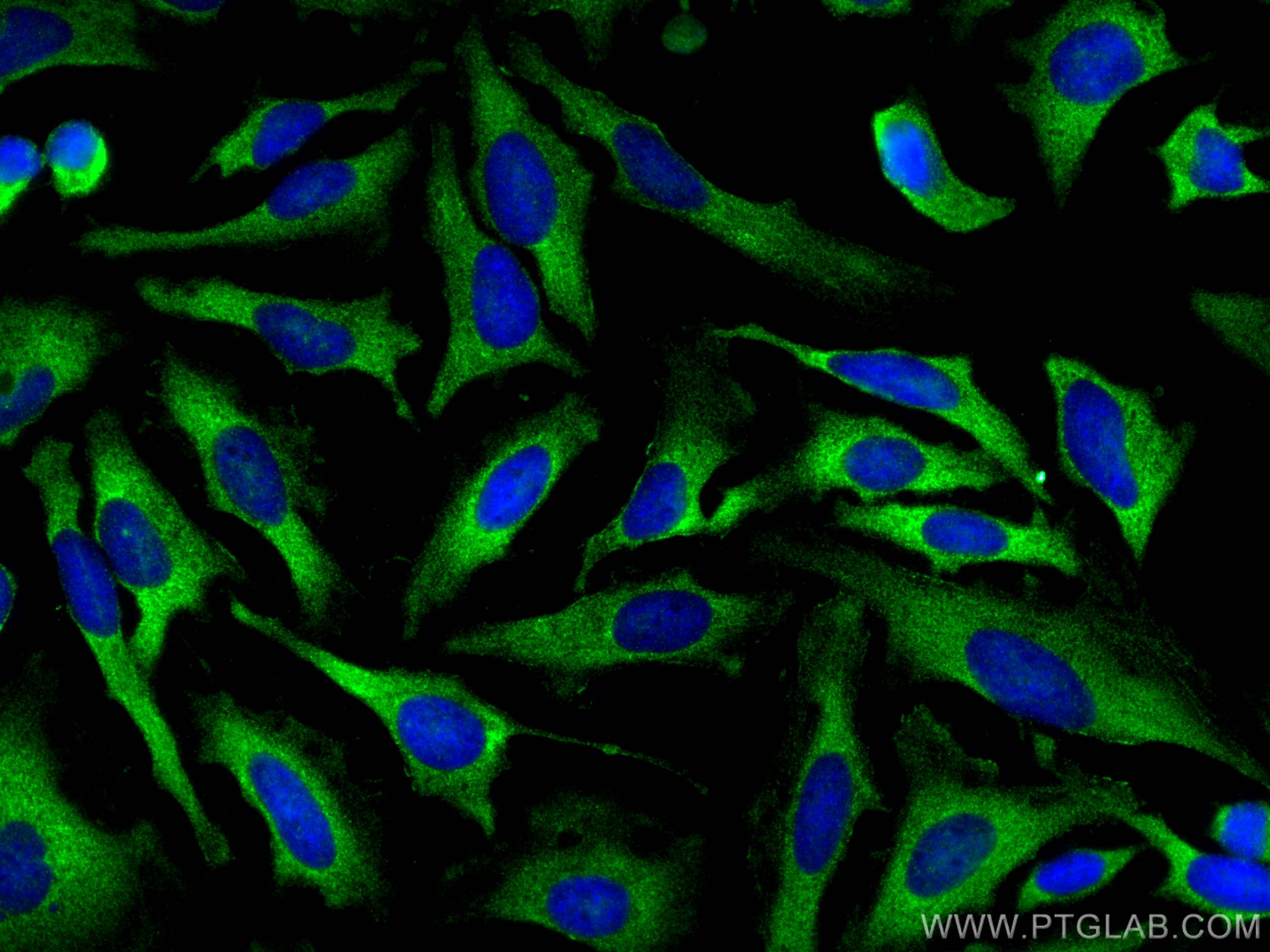 IF Staining of HeLa using 55396-1-AP