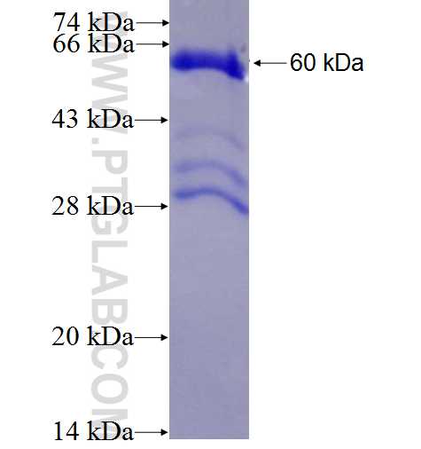 DSPP fusion protein Ag27490 SDS-PAGE