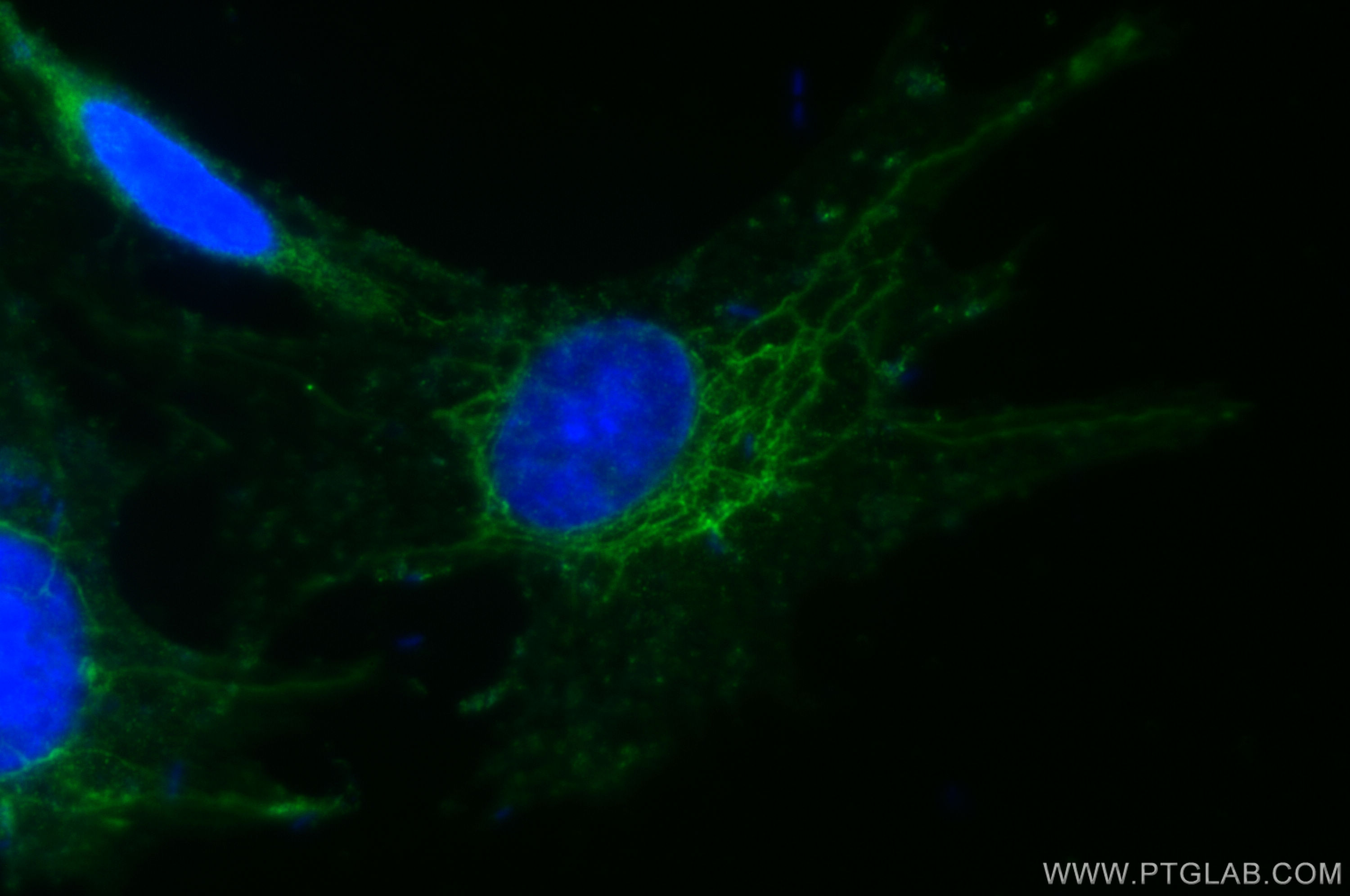 IF Staining of SH-SY5Y using 28438-1-AP