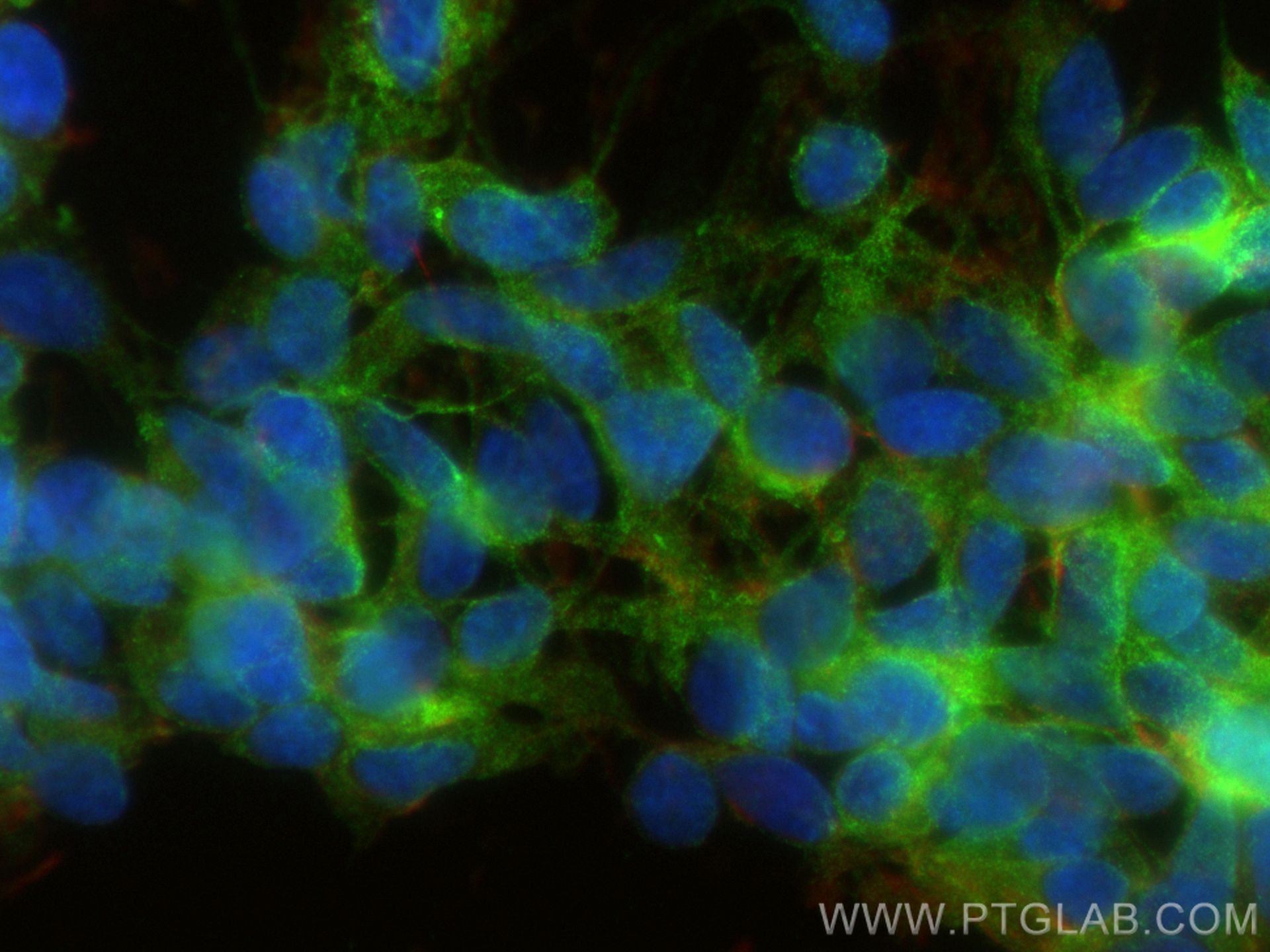 IF Staining of SH-SY5Y using 28438-1-AP