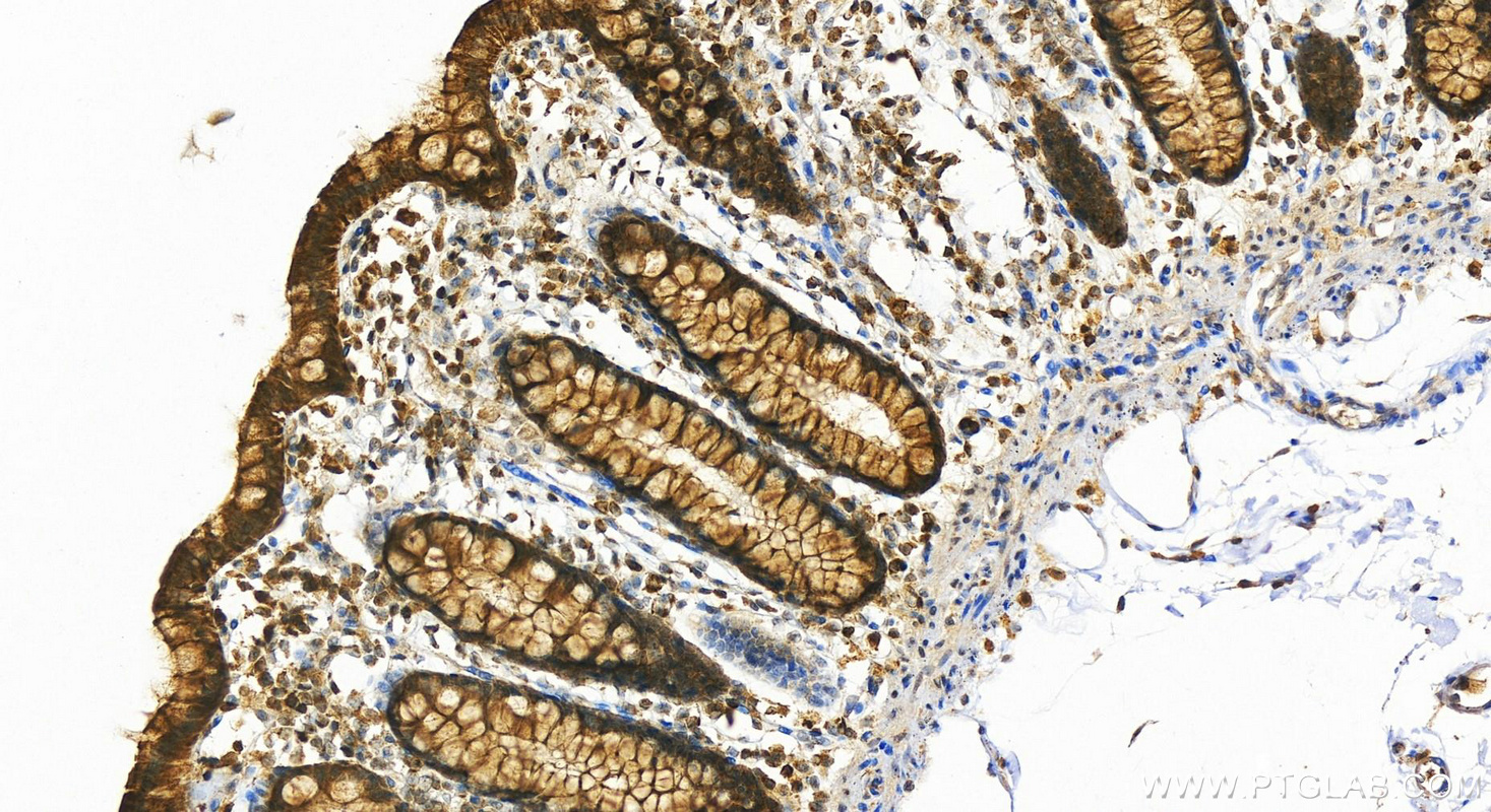 IHC staining of human colon using 18350-1-AP