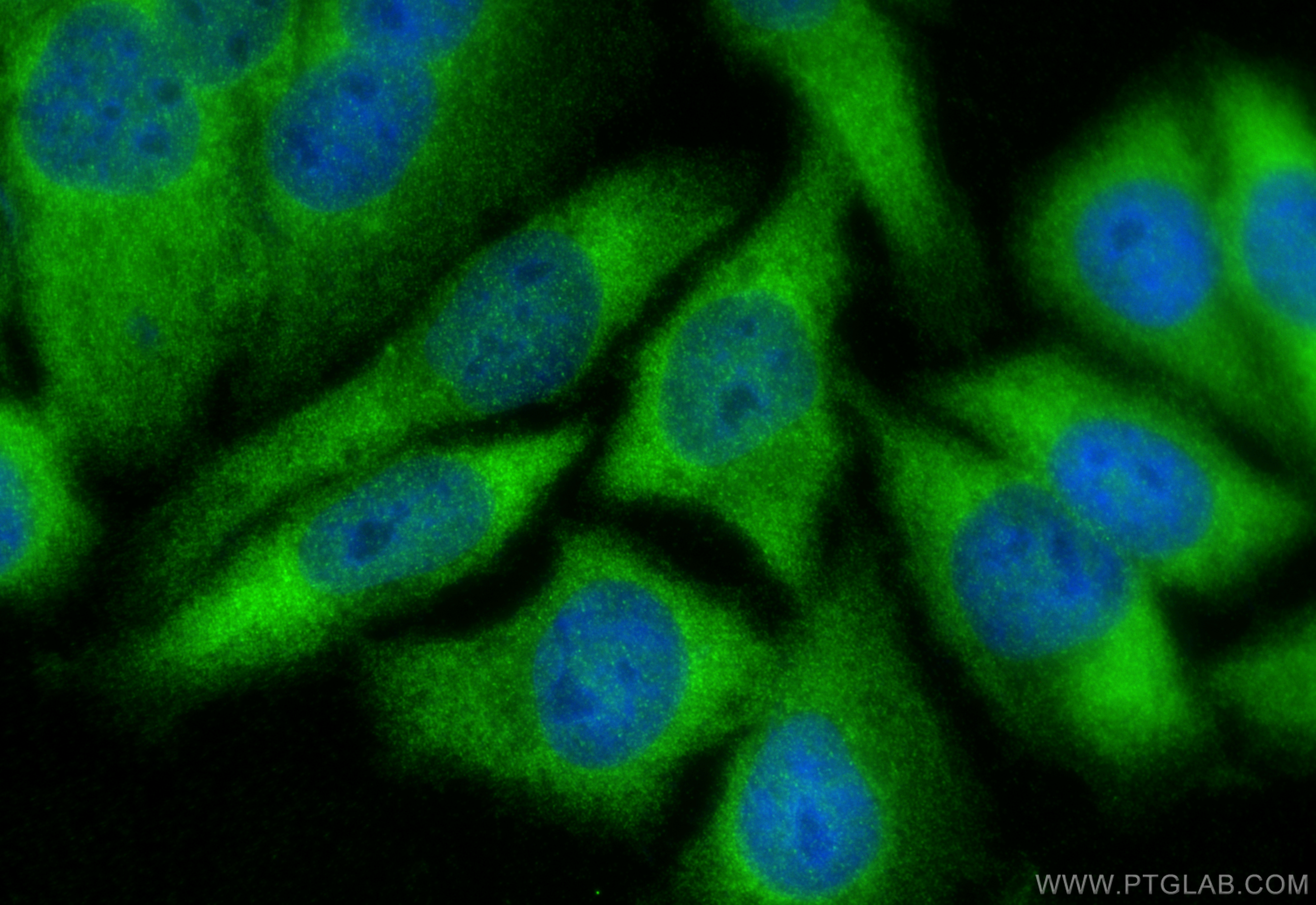 IF Staining of HepG2 using 15360-1-AP