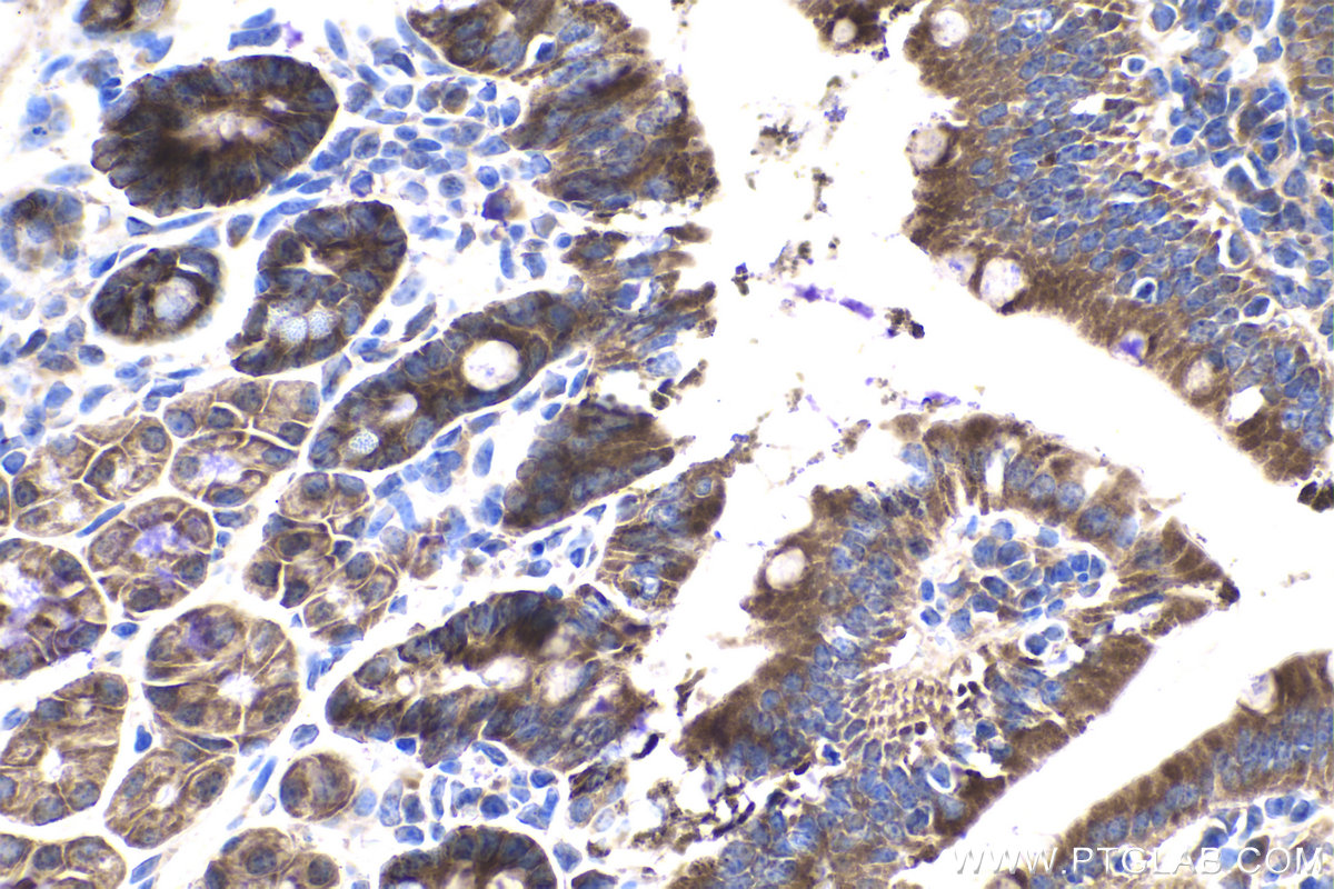 IHC staining of mouse small intestine using 15360-1-AP