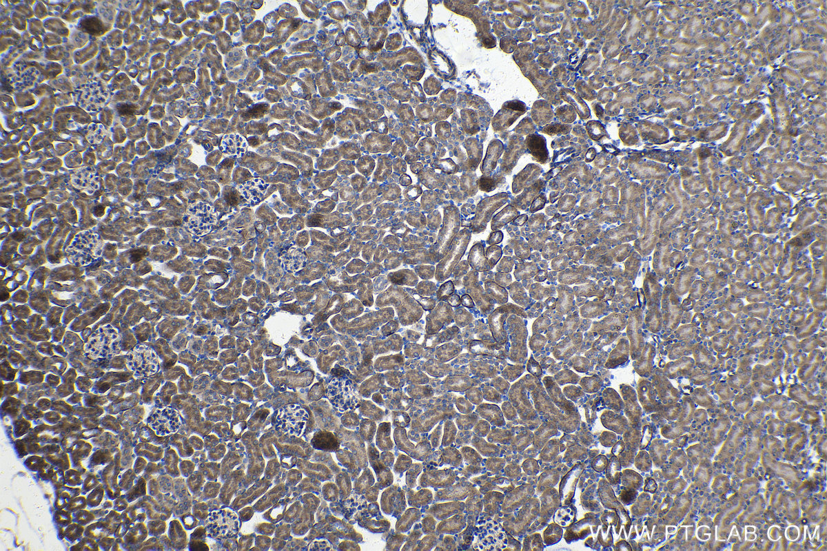 IHC staining of mouse kidney using 15360-1-AP