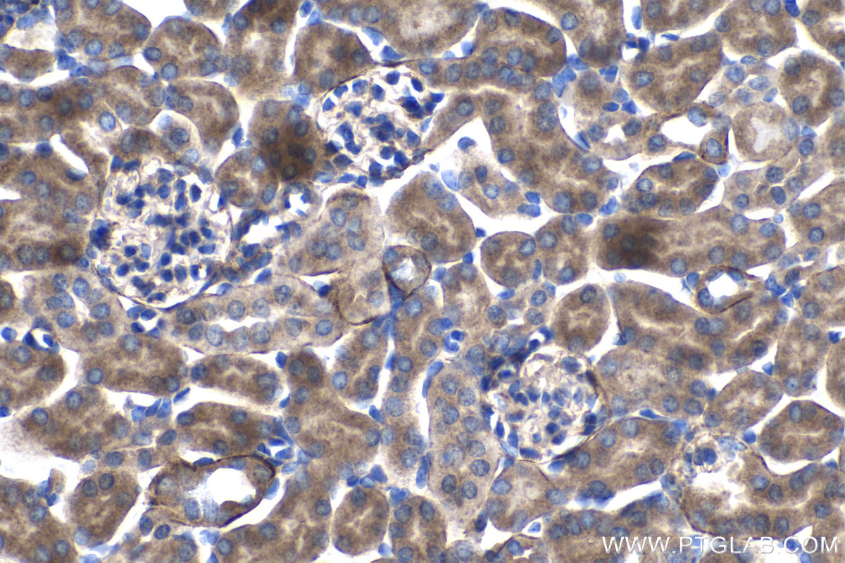 IHC staining of mouse kidney using 15360-1-AP