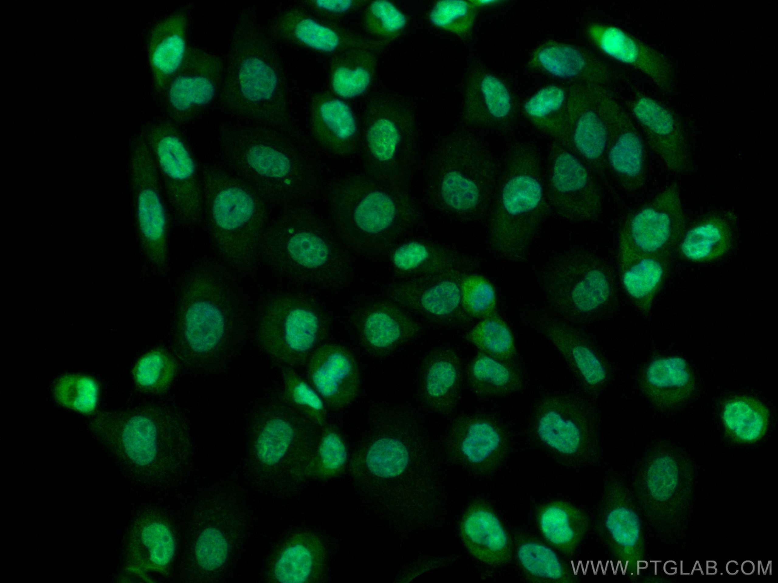 IF Staining of A431 using CL488-10204