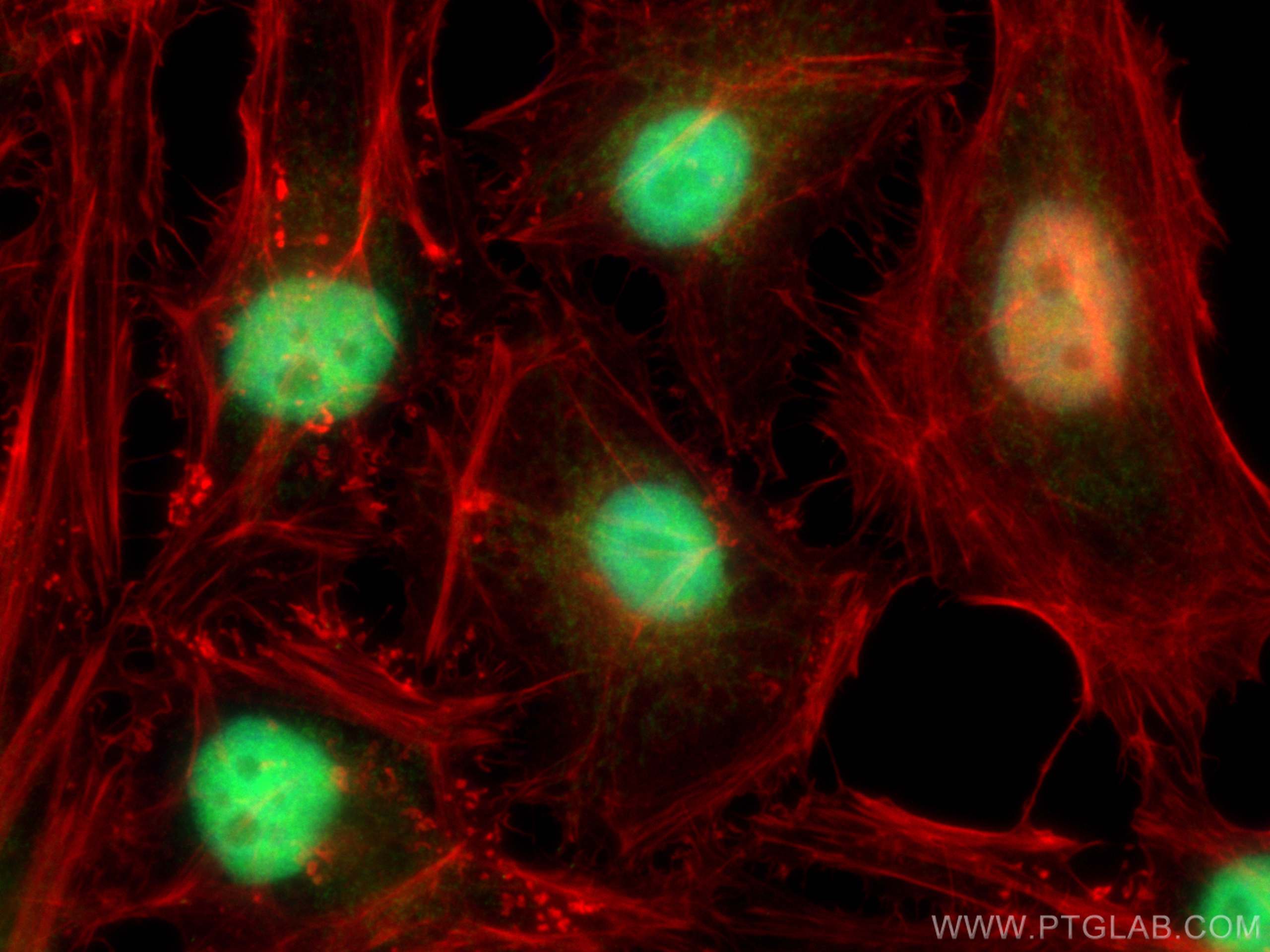 IF Staining of HeLa using 13740-1-AP