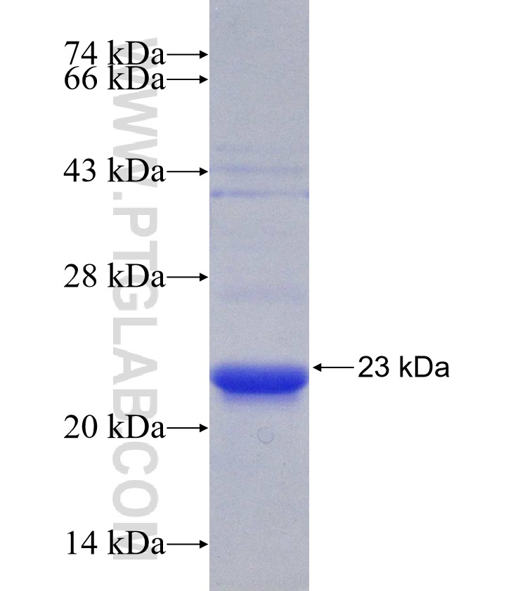 DUT fusion protein Ag30799 SDS-PAGE