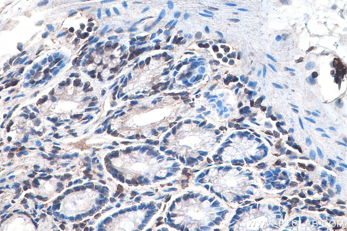 IHC staining of rat colon using 67672-1-Ig (same clone as 67672-1-PBS)