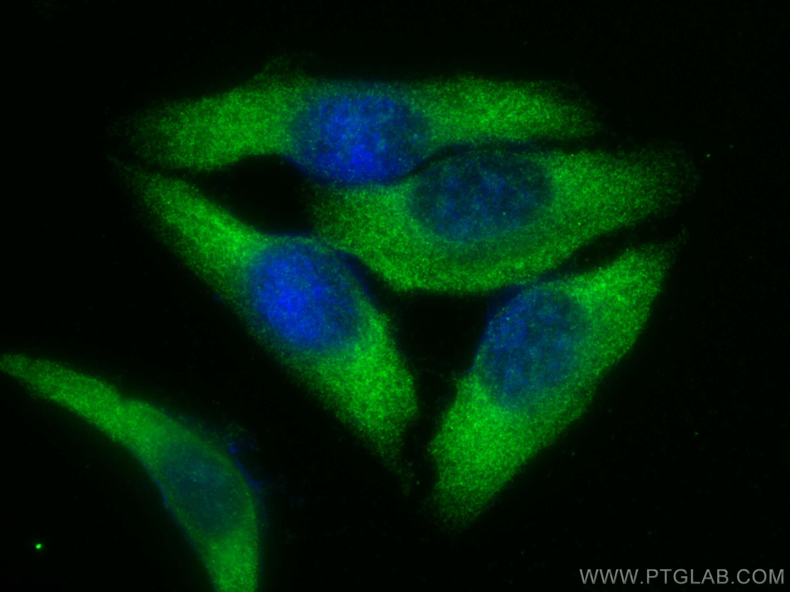 IF Staining of HepG2 using 12037-1-AP