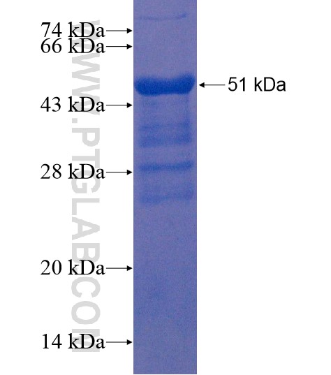 DYDC2 fusion protein Ag22250 SDS-PAGE