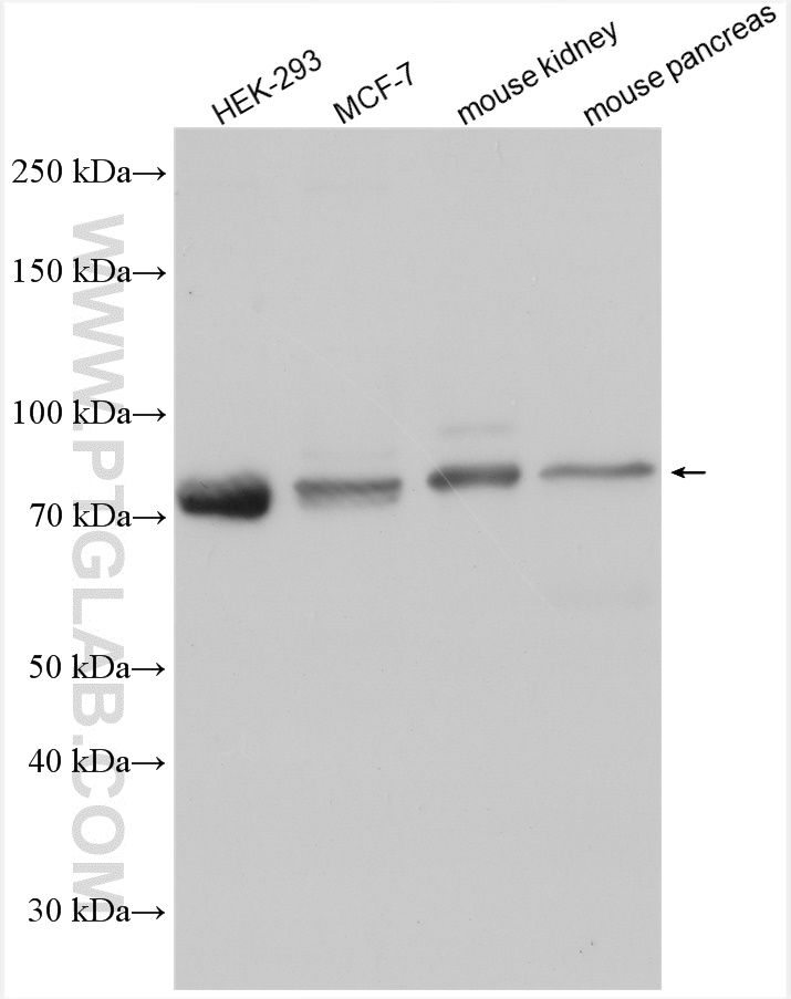 WB analysis using 12001-1-AP