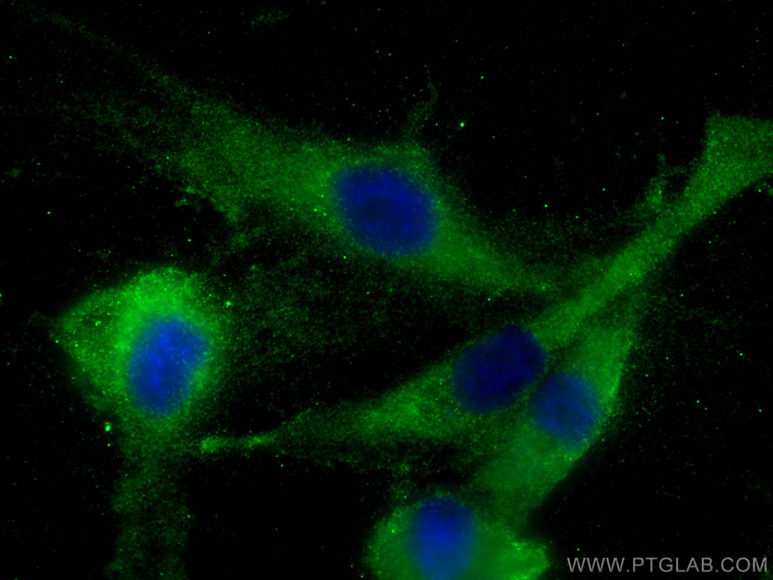 IF Staining of HUVEC using 13808-1-AP