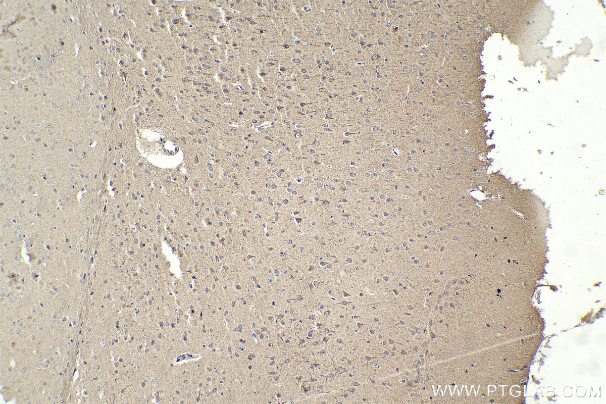 IHC staining of mouse brain using 18885-1-AP