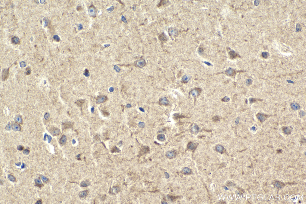 IHC staining of mouse brain using 18885-1-AP